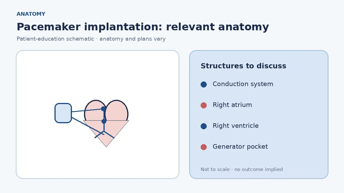 Medical illustration of the heart's conduction system and chambers relevant to bradycardia pacing