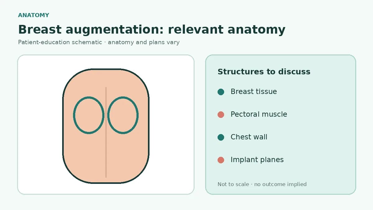 Medical cross-section showing breast tissue, pectoral muscle, chest wall and common implant placement planes used in augmentation