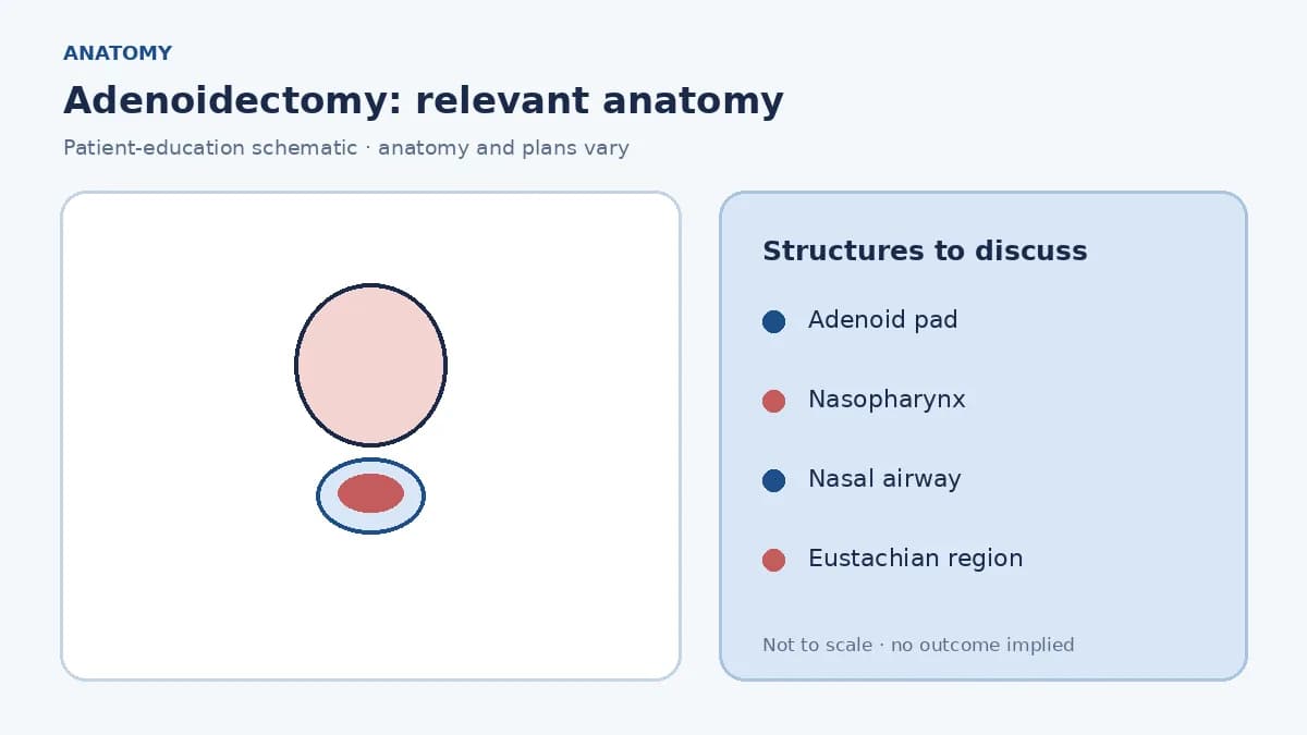 Medical illustration of adenoid tissue in the nasopharynx behind the nasal cavity