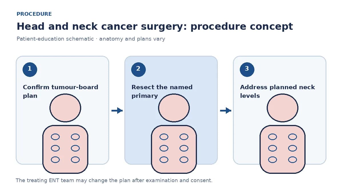 Clinical diagram of planned primary resection and neck-level clearance without implying a specific outcome