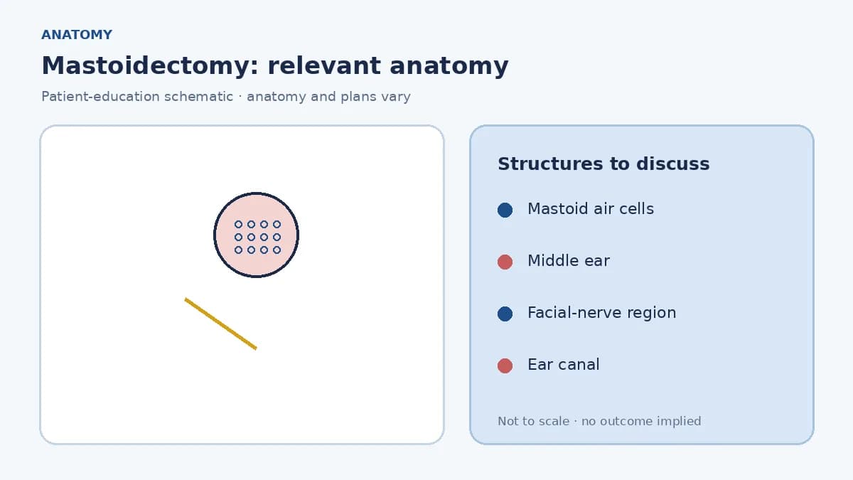 Medical illustration of mastoid air cells behind the ear and their relationship to the middle ear and facial nerve