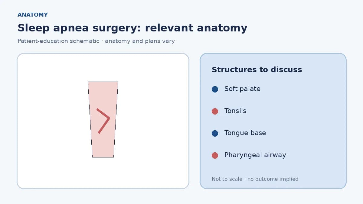 Medical illustration of palate, tonsils and tongue-base narrowing the pharyngeal airway during sleep
