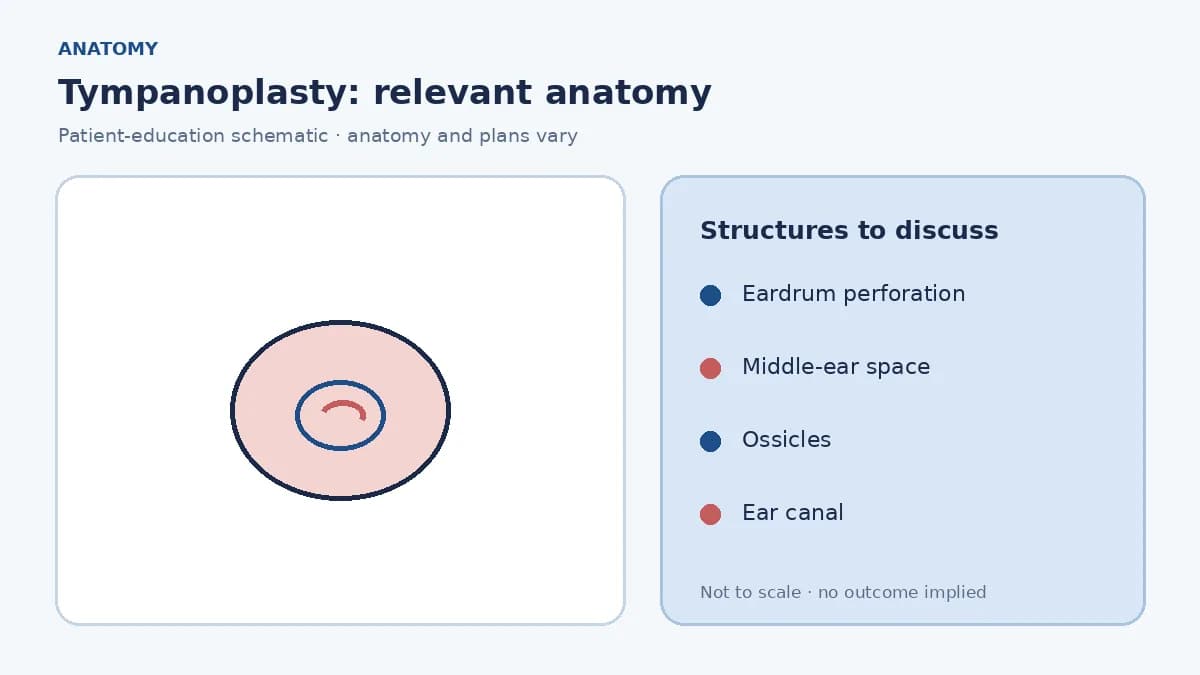 Medical illustration of the eardrum, middle-ear space and ossicles with a perforation in the tympanic membrane