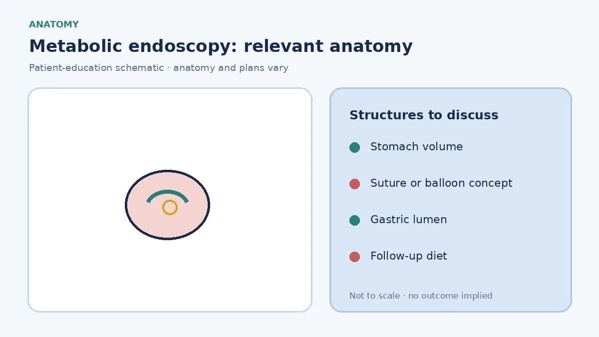 Medical illustration of the stomach showing volume-reduction or space-occupying endoscopic concepts
