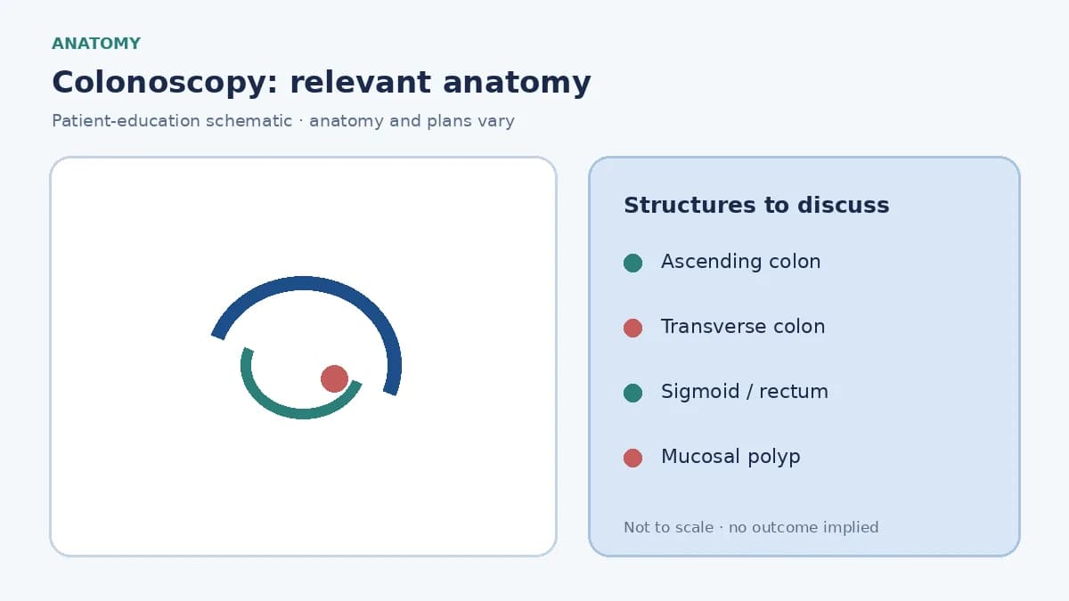 Medical illustration of the colon and rectum showing a polyp on the mucosal lining