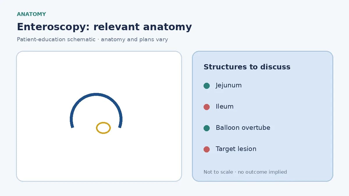 Medical illustration of the jejunum and ileum beyond the reach of a standard endoscope