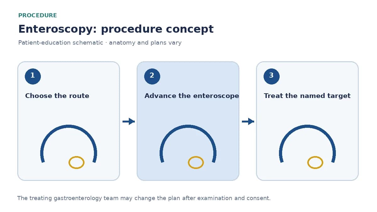Clinical diagram of a balloon enteroscope advancing through the small bowel
