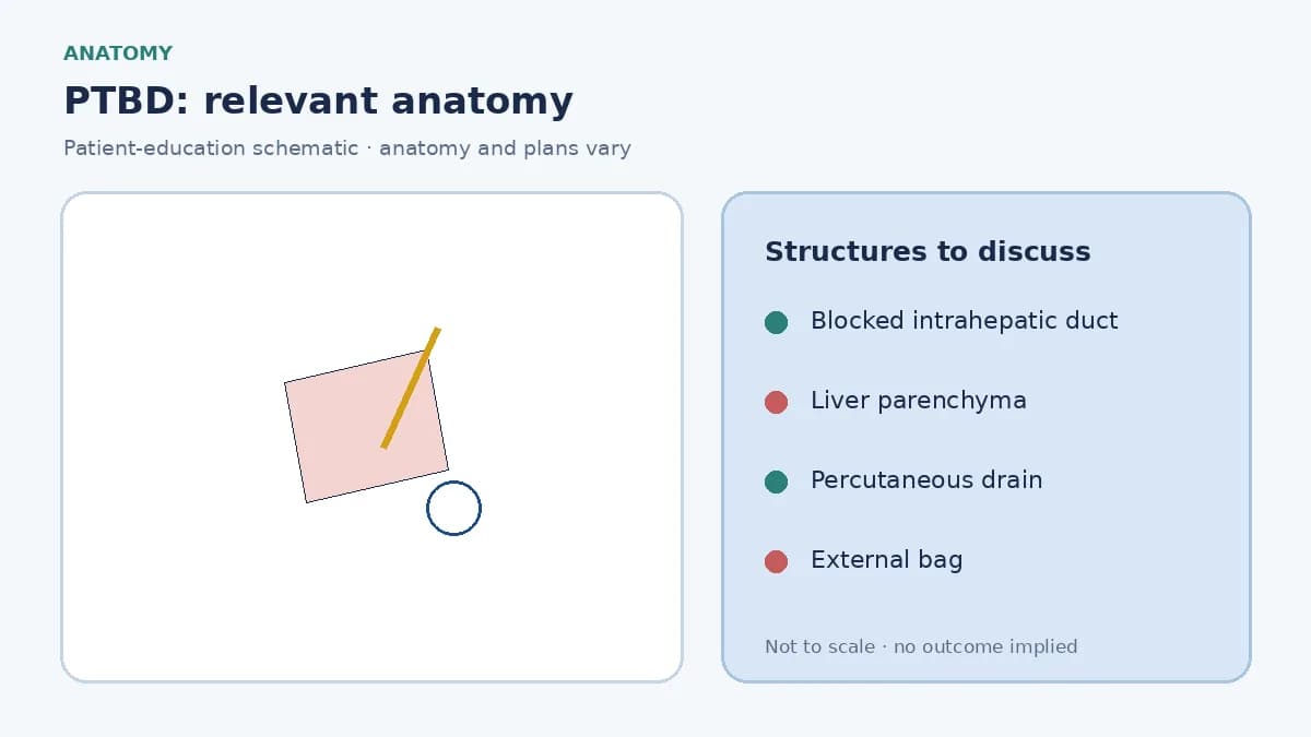 Medical illustration of a blocked bile duct inside the liver requiring percutaneous drainage