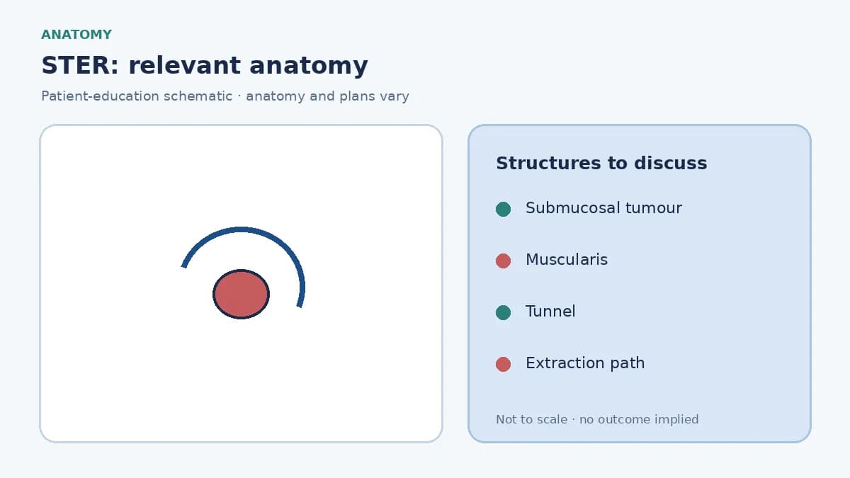 Medical illustration of a submucosal tumour in the oesophageal or gastric wall