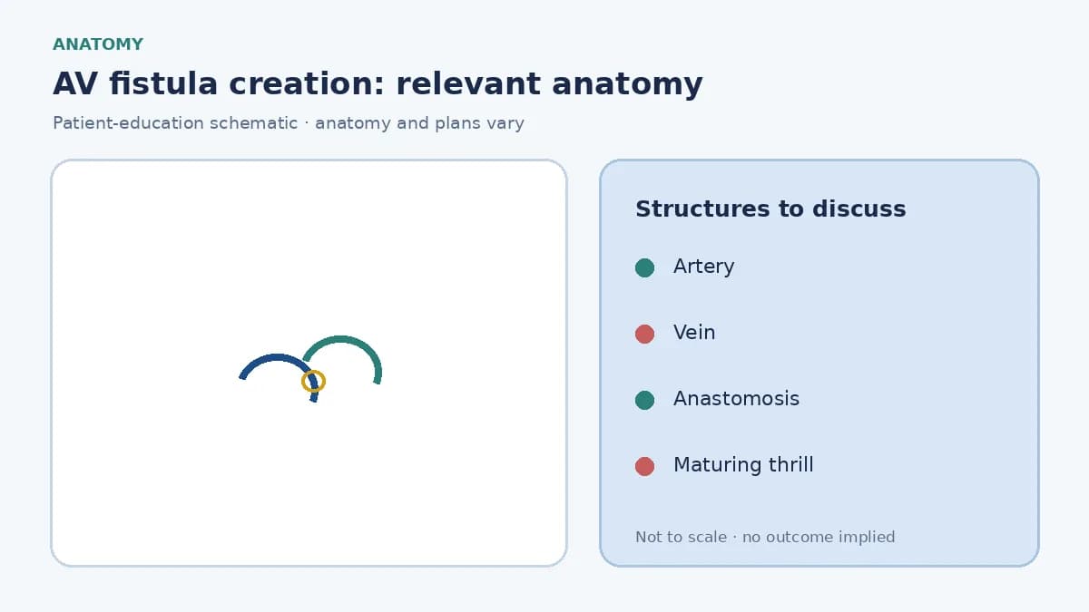 Medical infographic of an arteriovenous fistula showing an artery joined to a vein in the forearm for hemodialysis needles