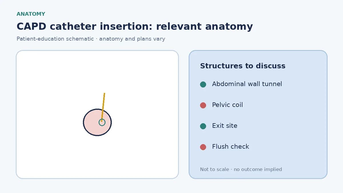 Medical infographic of a CAPD catheter tunnelled through the abdominal wall into the pelvis for peritoneal dialysis