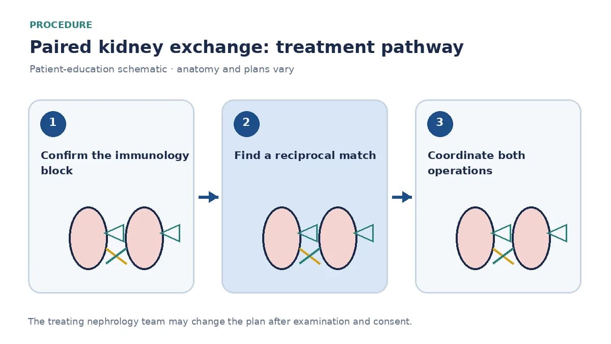 Step-by-step paired-exchange pathway showing HLA review, match confirmation and coordinated transplant day