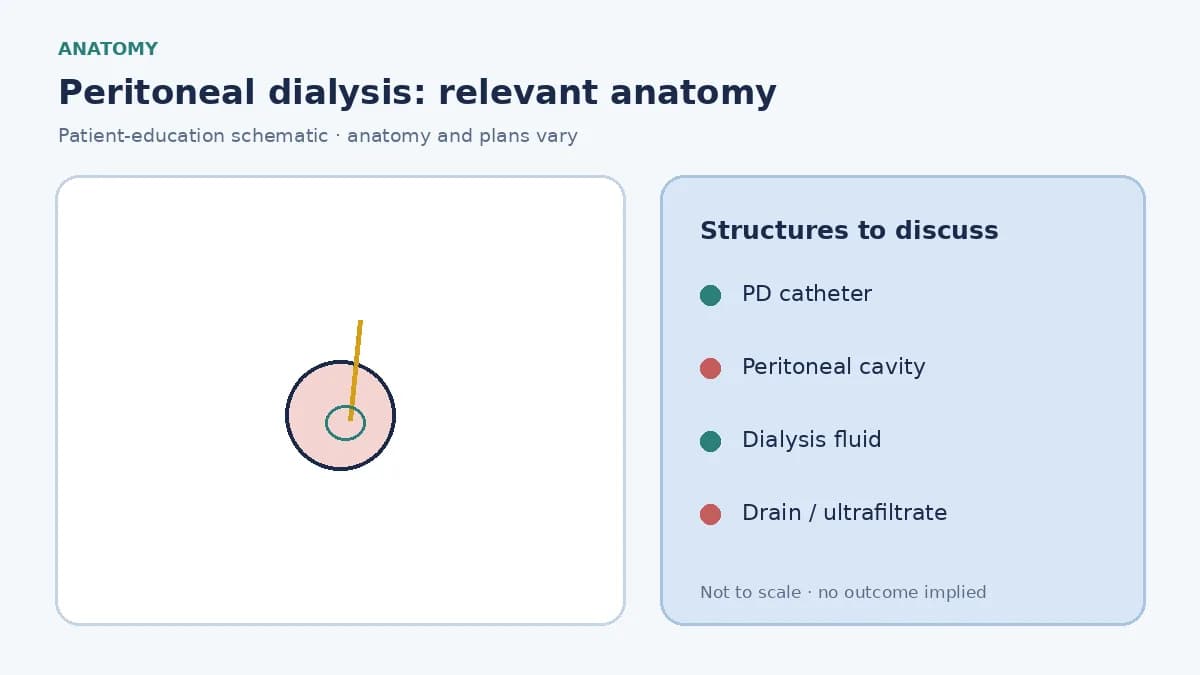 Medical infographic of peritoneal dialysis showing a peritoneal catheter, dialysis fluid in the abdomen and waste-fluid drainage