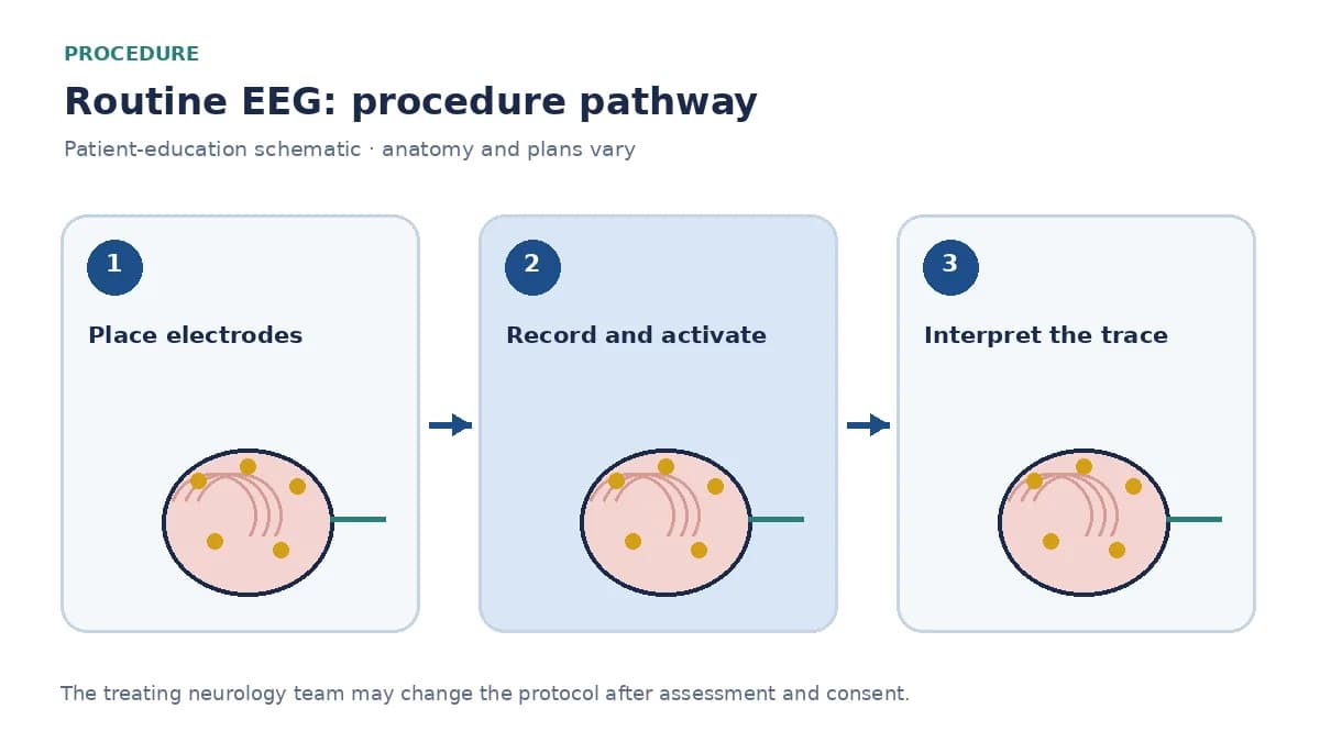 Numbered routine EEG pathway showing electrode placement, activation procedures and specialist interpretation