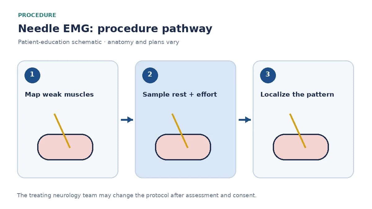 Numbered EMG pathway showing clinical mapping, muscle sampling at rest and activation, and interpretation