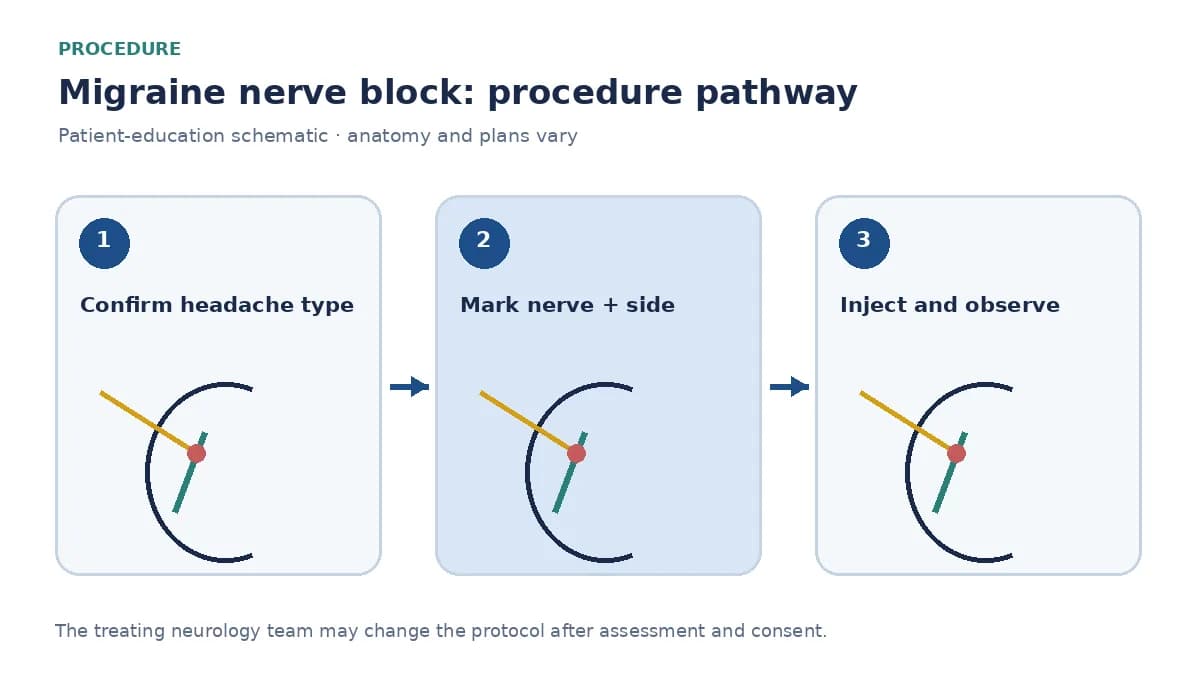 Numbered migraine nerve-block pathway showing headache review, target marking and local injection
