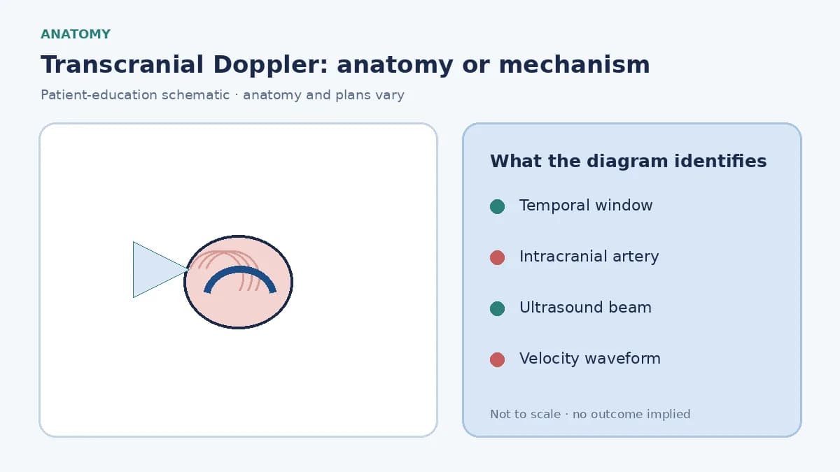 Patient-education diagram showing ultrasound through a temporal cranial window measuring intracranial artery velocity