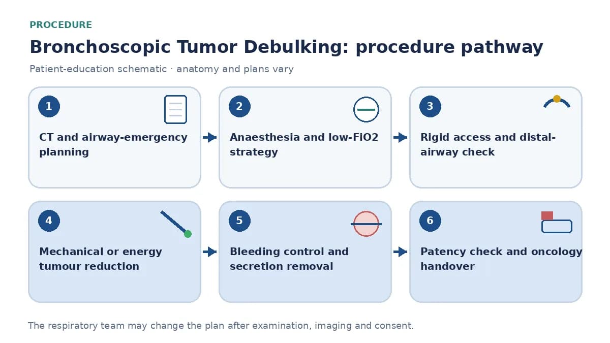 Tumour-debulking pathway showing contrast-CT rescue planning, general anaesthesia and low-FiO2 strategy, rigid access, controlled mechanical or energy reduction, bleeding control and oncology handover