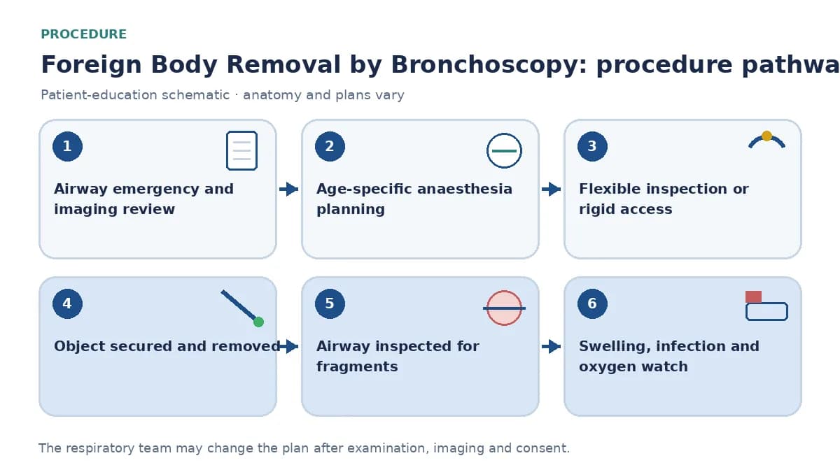 Foreign-body-removal pathway showing emergency assessment and imaging, age-specific anaesthesia, flexible inspection or rigid access, controlled extraction, bilateral fragment check and swelling or infection monitoring