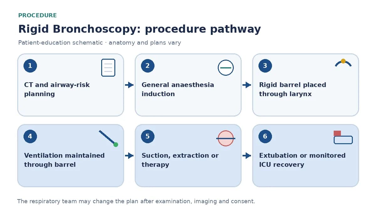 Rigid bronchoscopy pathway showing CT airway-risk review, general anaesthesia, barrel placement, ventilation through the tube, selected extraction or intervention, haemostasis and monitored extubation
