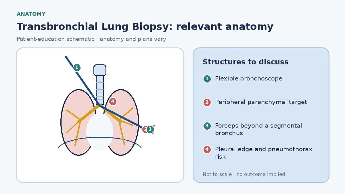 Educational lung schematic showing a flexible bronchoscope wedged in a segmental airway, forceps extending into peripheral parenchyma, an HRCT-selected biopsy target and the nearby pleural edge where pneumothorax can occur