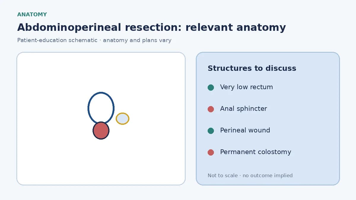Medical illustration of a very low rectal tumour involving the anal sphincter, showing why APR may be considered
