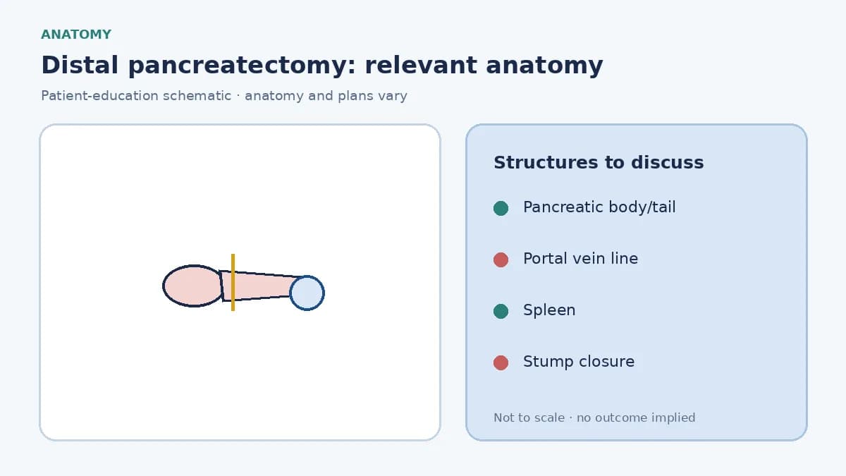 Medical illustration of the pancreatic body and tail to the left of the portal vein, with the spleen nearby