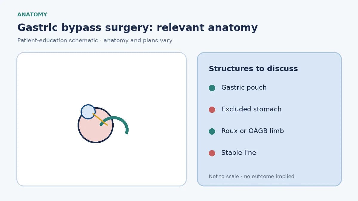 Medical illustration of the stomach and small bowel before gastric bypass, showing the planned pouch and Roux limb