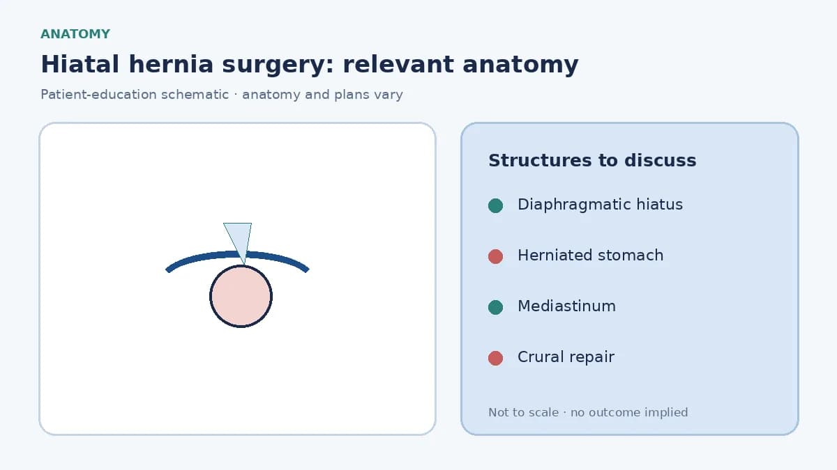 Medical illustration of a hiatal hernia with stomach migrating through the diaphragmatic hiatus into the chest