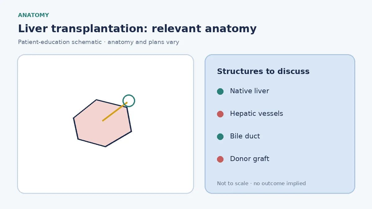 Medical illustration of native liver anatomy, hepatic vessels and bile duct involved in liver transplantation