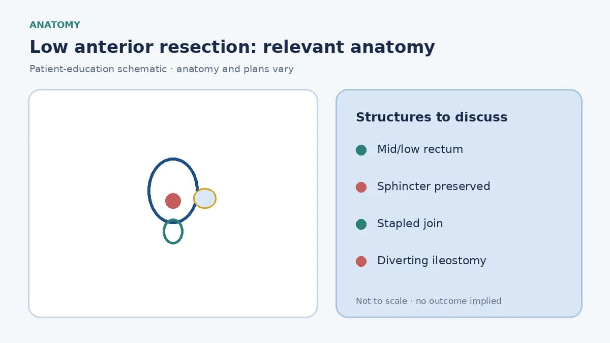 Medical illustration of the rectum and sphincter showing a mid or low tumour suitable for low anterior resection