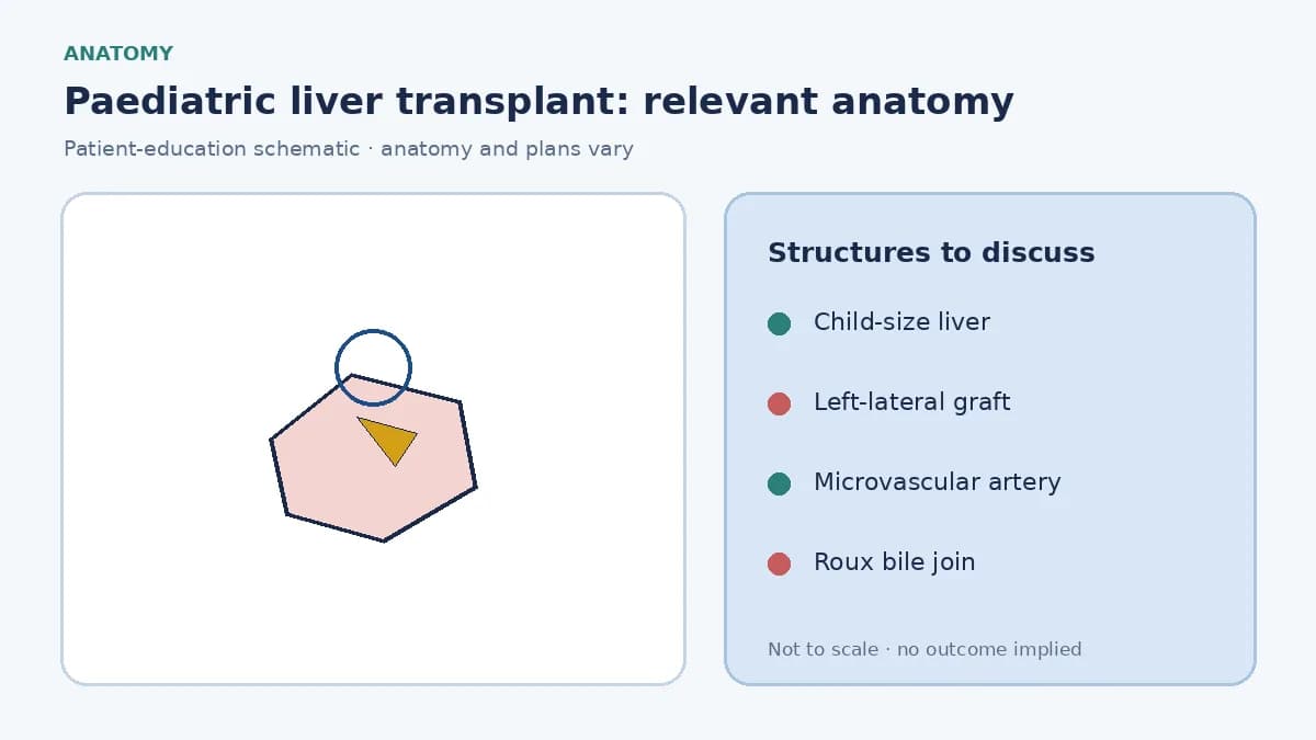 Medical illustration of a child's liver, bile ducts and a size-matched left-lateral graft used in paediatric transplantation
