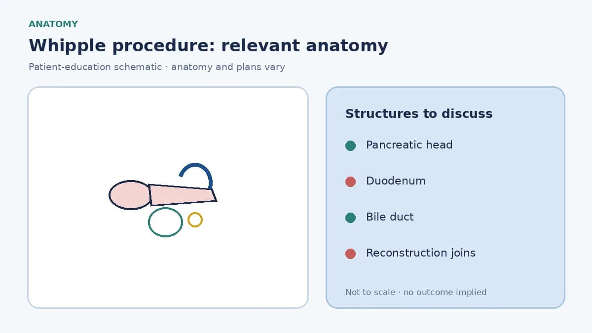 Medical illustration of the pancreatic head, bile duct, duodenum and nearby vessels involved in a Whipple procedure