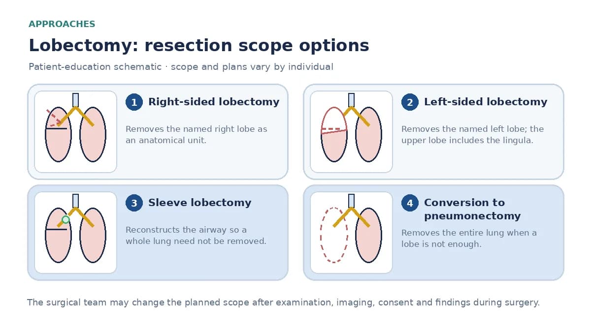 Medical infographic comparing right upper lobectomy, left lower lobectomy, sleeve lobectomy reconstructing the airway, and conversion to pneumonectomy when a lobe is not enough.