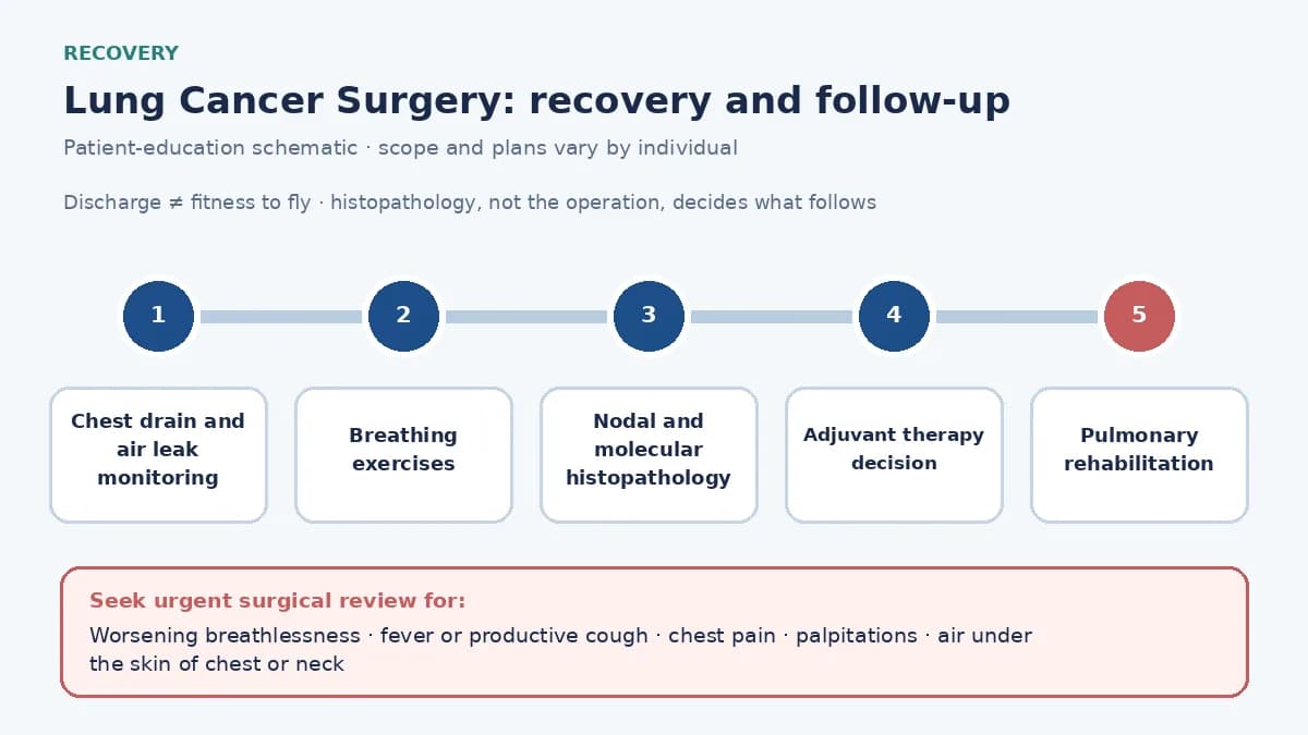 Medical infographic of the lung cancer recovery pathway: chest drain and air leak monitoring, breathing exercises, nodal and molecular histopathology, the adjuvant therapy decision and pulmonary rehabilitation.