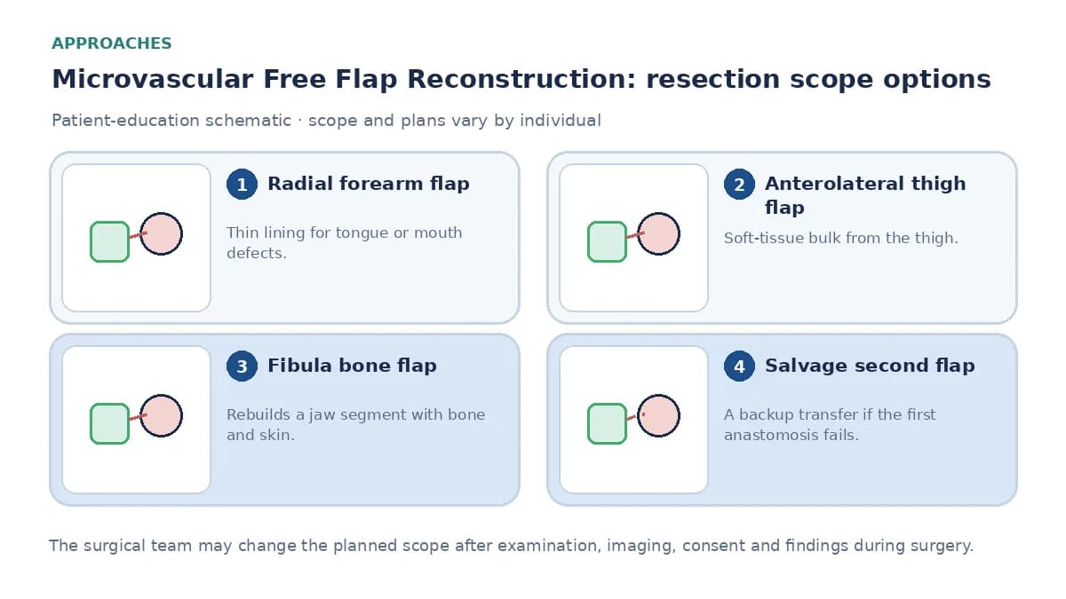 Medical infographic comparing radial forearm, anterolateral thigh and fibula bone flaps, two-team operating, and a salvage second flap if the first anastomosis fails.