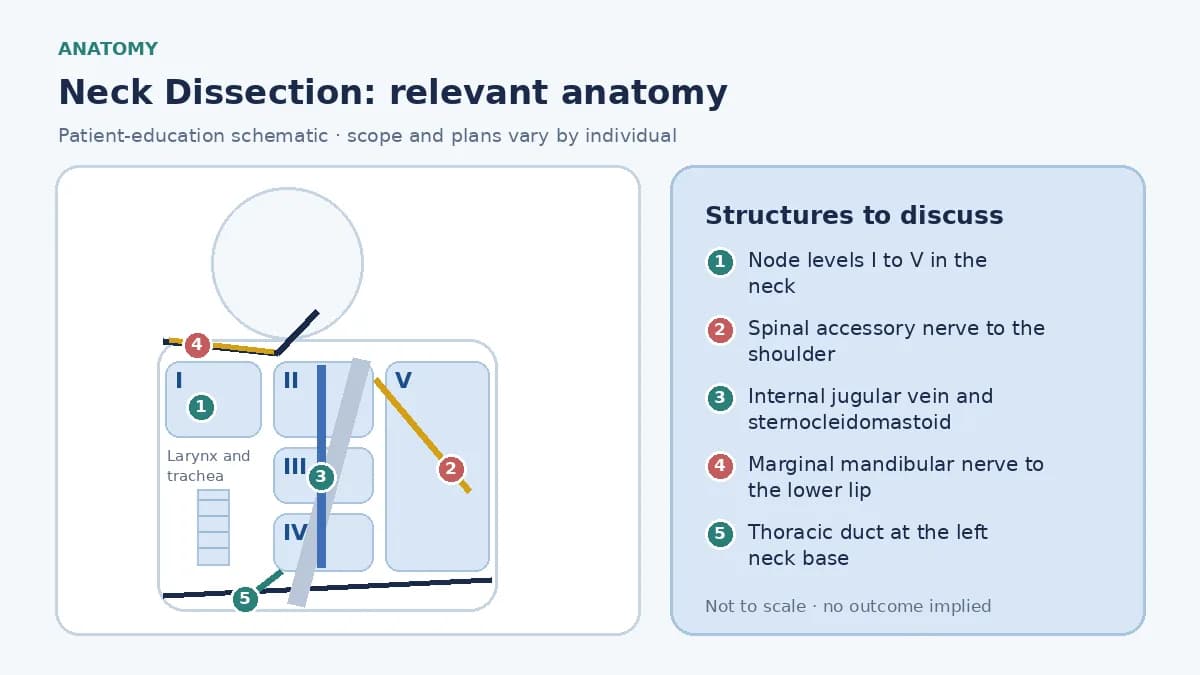 Medical illustration of neck lymph node levels one to five for dissection planning, marking the spinal accessory nerve, internal jugular vein, marginal mandibular nerve and thoracic duct as structures preserved where disease allows.