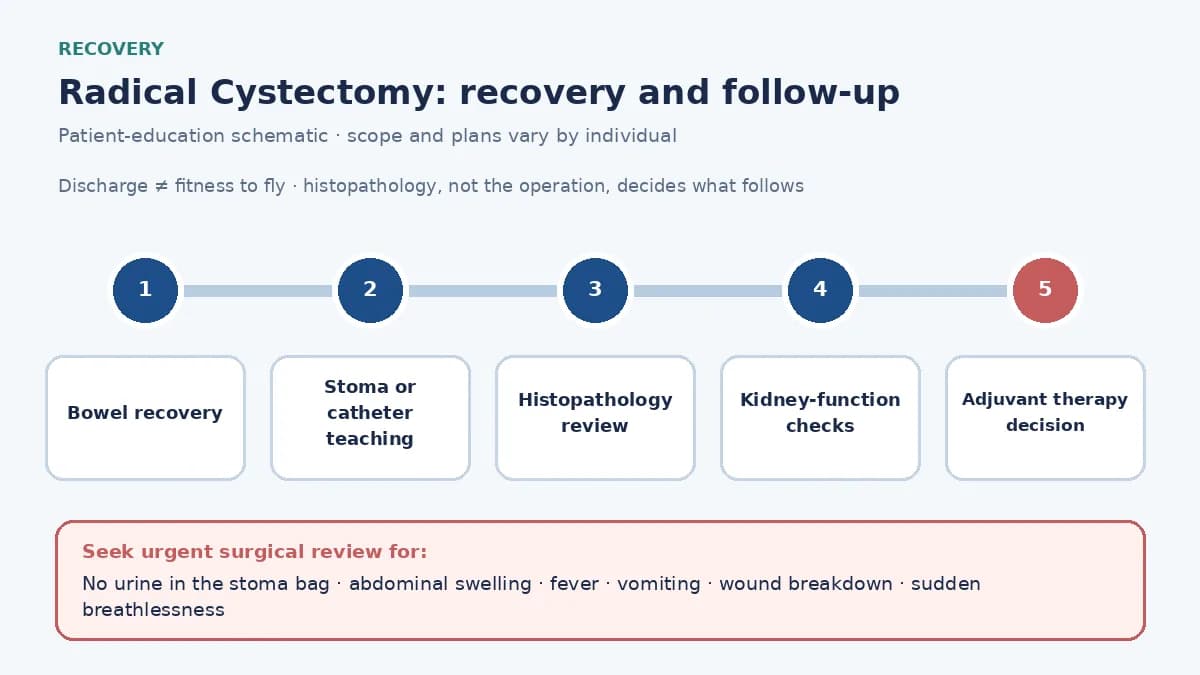 Medical infographic of the radical cystectomy recovery pathway: bowel recovery, stoma or catheter teaching, histopathology, kidney-function checks and the adjuvant therapy decision.