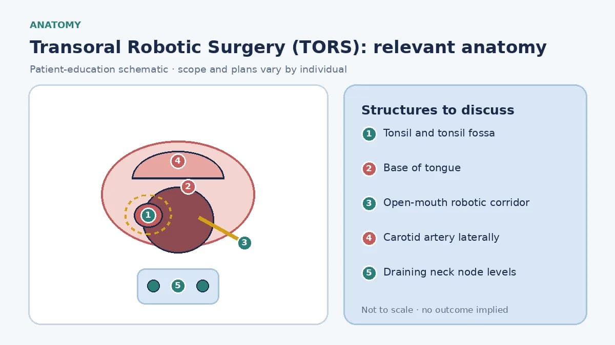 Medical illustration of transoral robotic surgery anatomy: tonsil and base of tongue in the oropharynx, the open-mouth corridor for robotic instruments, the carotid artery laterally, and the draining neck node levels.