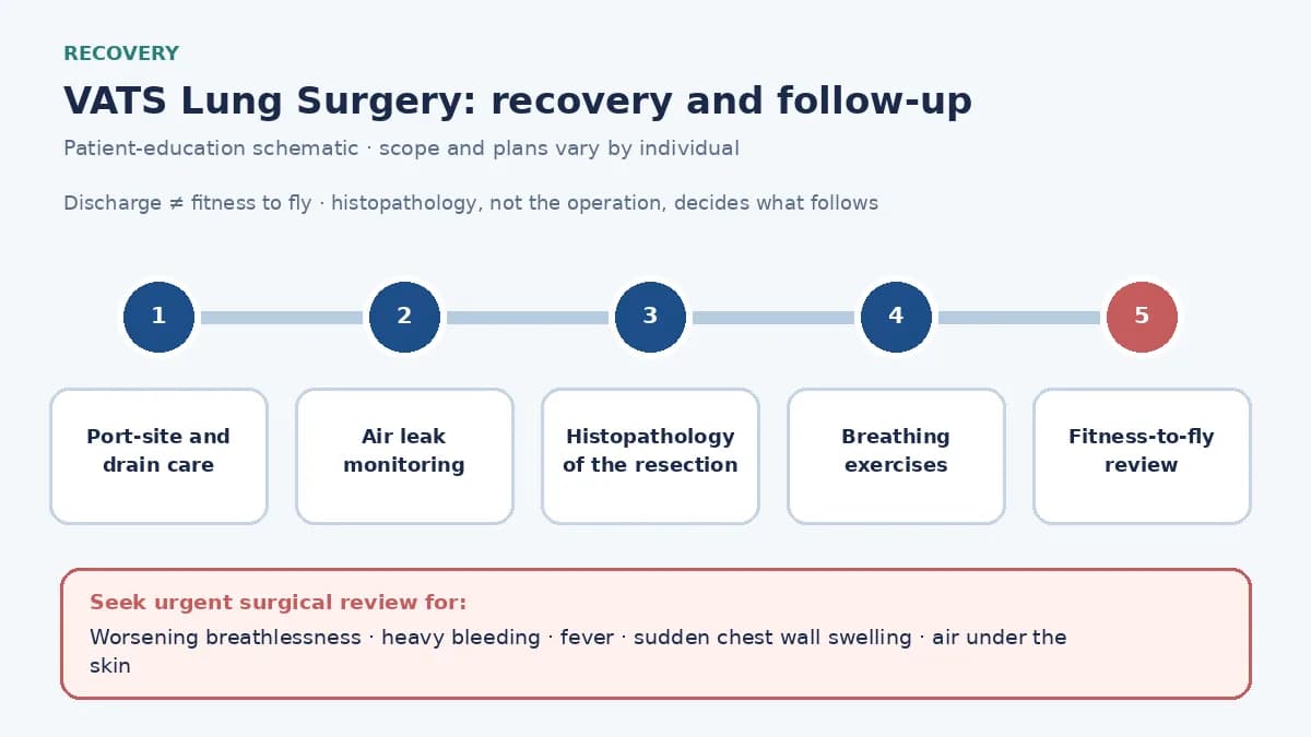 Medical infographic of the VATS recovery pathway: port-site and drain care, air leak monitoring, histopathology of the resected lobe or segment, and breathing exercises before travel home.
