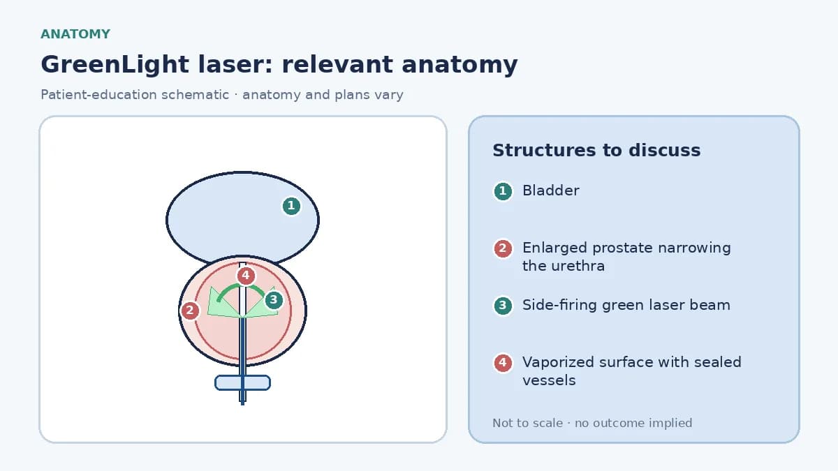 Medical infographic of GreenLight laser anatomy showing the bladder, an enlarged prostate narrowing the urethra and a side-firing green laser beam vaporizing the inner tissue while sealing blood vessels