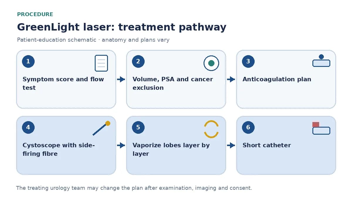Step-by-step GreenLight laser pathway infographic showing symptom score and flow test, prostate volume and PSA review, anticoagulation plan, cystoscopic laser vaporization, coagulation and short catheter placement