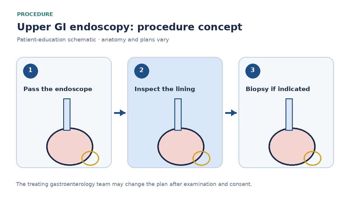 Clinical diagram of a flexible endoscope passing through the mouth into the stomach