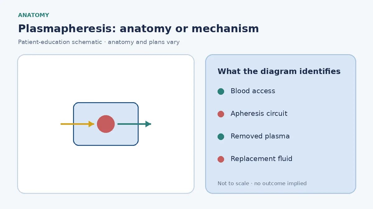 Patient-education diagram showing blood separated in an apheresis circuit with plasma removed and replacement fluid returned