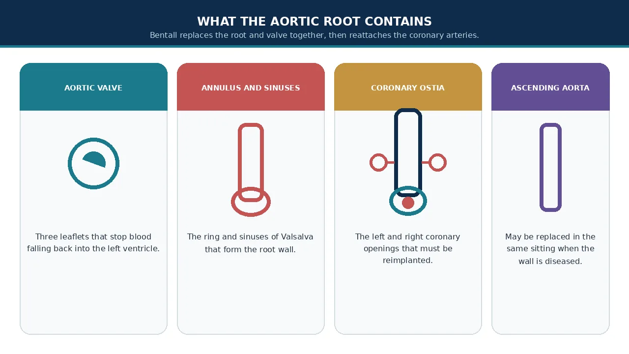 Educational illustration of the aortic valve, annulus, coronary ostia and ascending aorta
