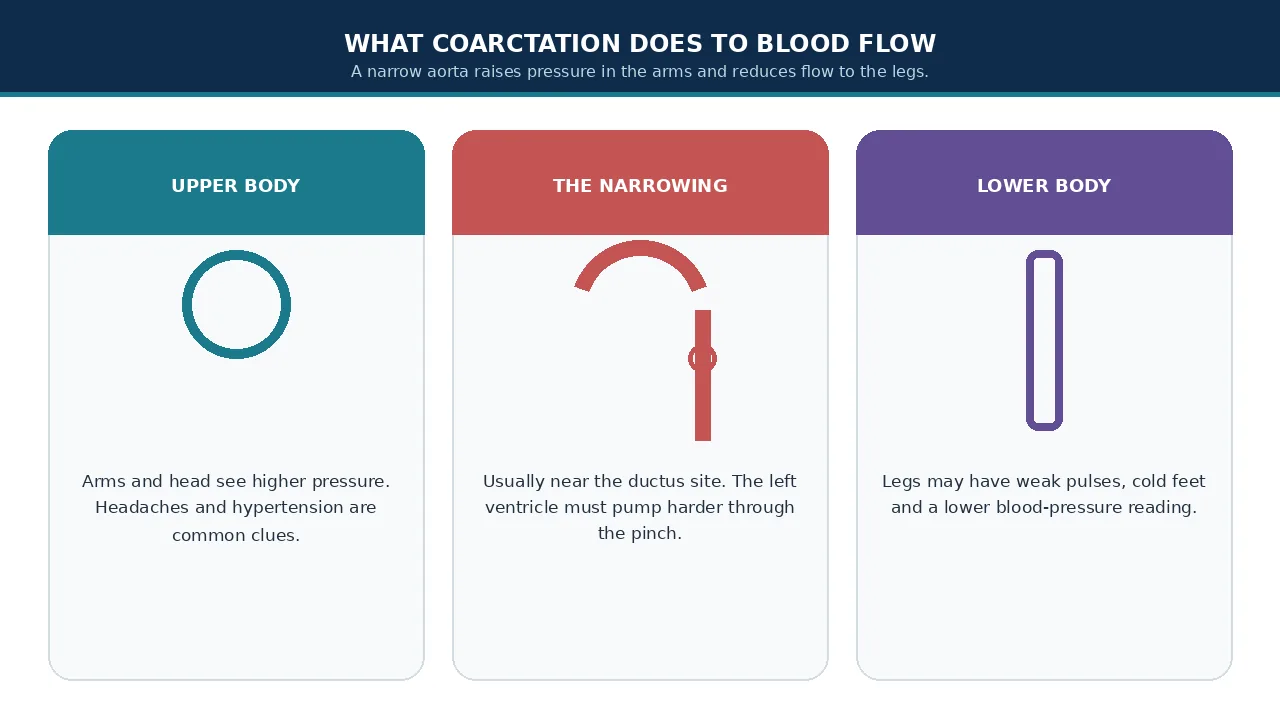 Educational illustration of higher arm pressure, the aortic pinch and weaker leg flow