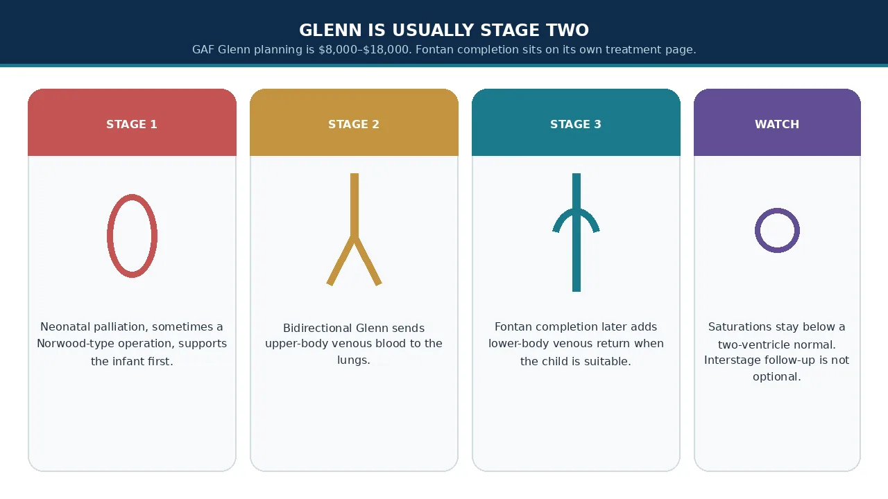 Educational illustration of neonatal palliation, Glenn and Fontan completion