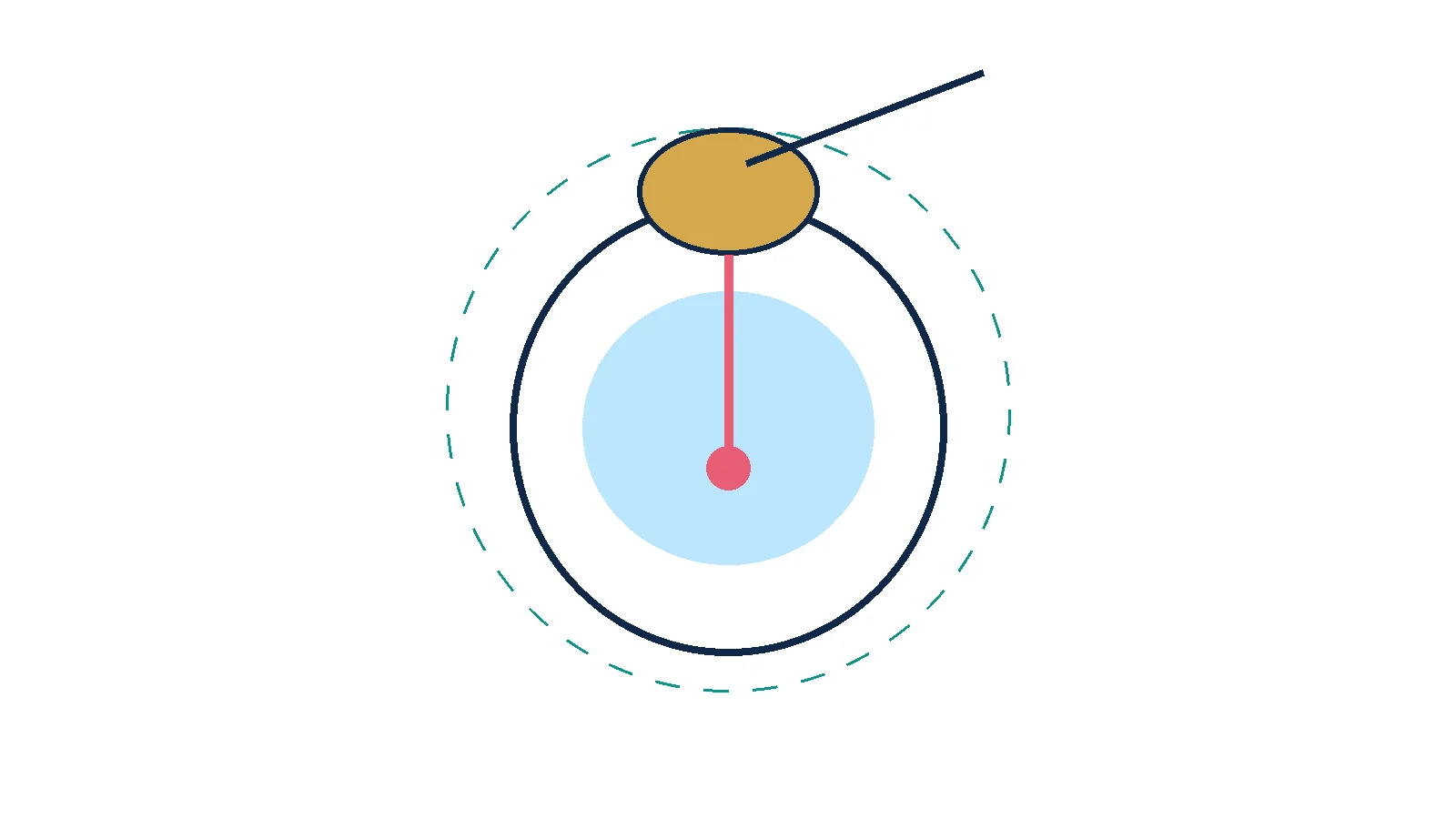 Schematic of an implanted abdominal port used for repeated IP cycles