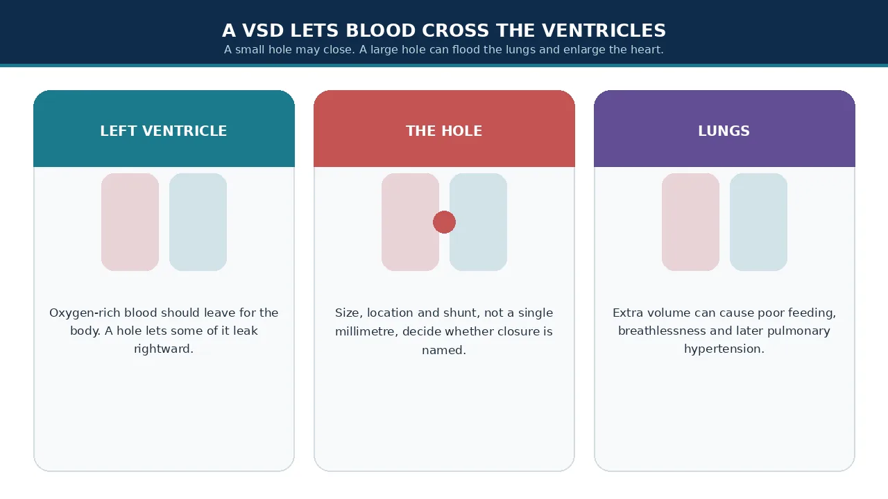 Educational illustration of left ventricle, the hole and extra lung flow